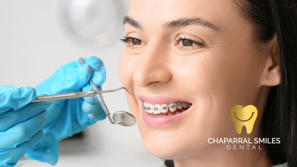 Orthodontic Care for Adults_ Is It Too Late