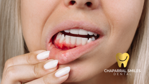 The Role of Zinc in Oral Wound Healing